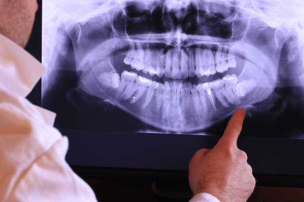 Best Broken Tooth Emergency  in Lisbon, OH