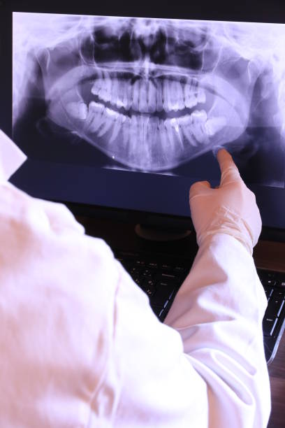 Best Dentist for Tooth Abscess  in Lisbon, OH