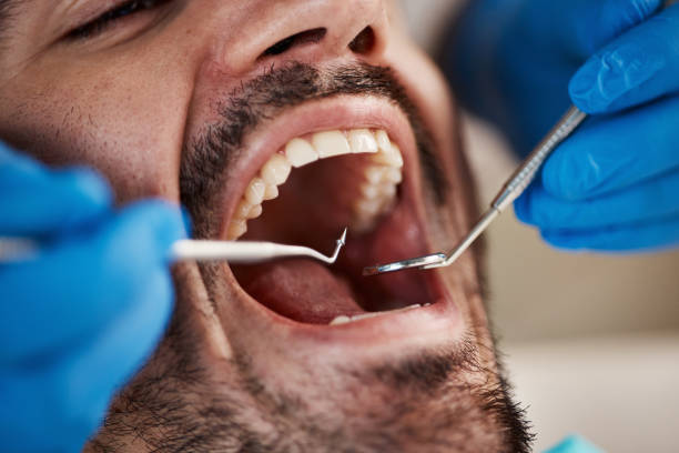 Best Emergency Gum Pain Relief  in Lisbon, OH
