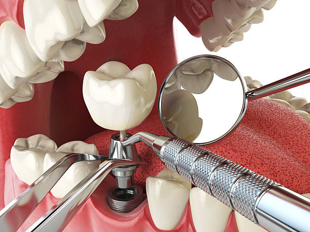Best Knocked-Out Tooth Emergency  in Lisbon, OH